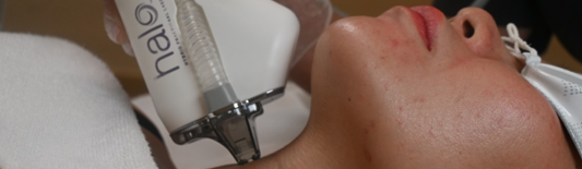 Halo – Sciton Lasers