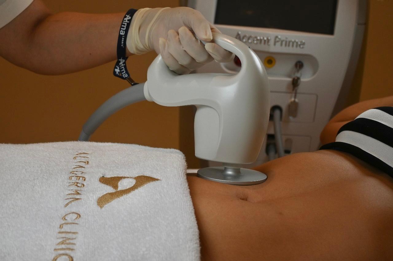 Accent Prime – Body – Alma Lasers