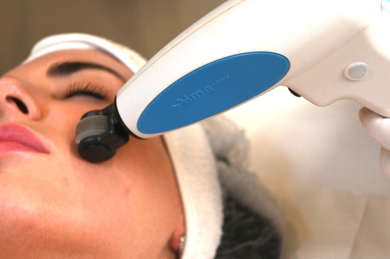 Fractional Radio Frequency