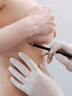 Delicate,Scrupulous,Plastic,Surgeon,Drawing,Special,Marks